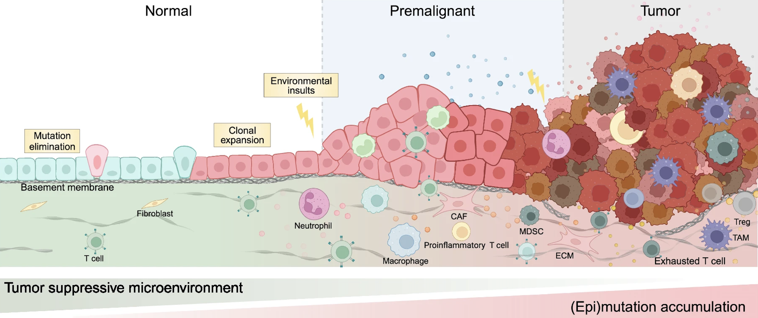 Tumor carcinogenesis illustration